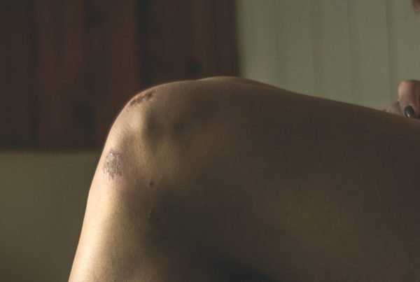 Personal injury law offices near Newport Beach, CA